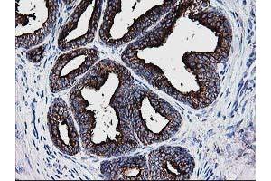 Image no. 3 for anti-Deoxythymidylate Kinase (Thymidylate Kinase) (DTYMK) antibody (ABIN1497918) (DTYMK Antikörper)