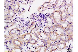 Formalin-fixed and paraffin embedded rat kidney tissue labeled with Anti-GPIIb Polyclonal Antibody, Unconjugated (ABIN748358) at 1:200 followed by conjugation to the secondary antibody, (SP-0023), and DAB staining (Integrin Alpha2b Antikörper  (AA 351-450))