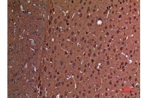 Immunohistochemistry (IHC) analysis of paraffin-embedded Rat Brain, antibody was diluted at 1:100.