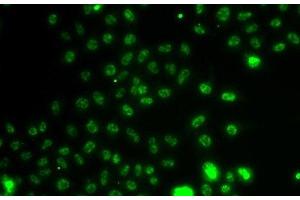 Immunofluorescence analysis of A549 cells using ETV1 Polyclonal Antibody (ETV1 Antikörper)
