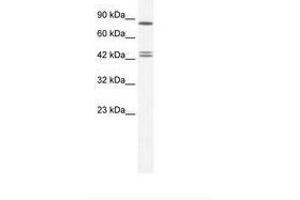 Image no. 1 for anti-Chromobox Homolog 8 (CBX8) (AA 260-309) antibody (ABIN6735988) (CBX8 Antikörper  (AA 260-309))
