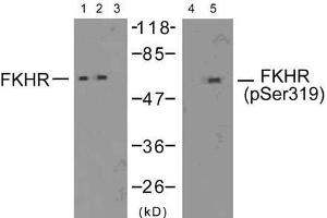 Western blot analysis of extracts from 293 cells (10% serum-treated, 15min) and HeLa cells (EGF-treated, 200ng/ml, 15min), using FKHR (Ab-319) antibody (E021161, Lane 1, 2 and 3) and FKHR (phospho-Ser319) antibody (E011136, Lane 4 and 5). (FOXO1 Antikörper  (pSer319))