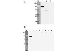 Western blot analysis of human Pref-1using anti-DLK1 (human), mAb (PF13-3)  at 1: 2,000 dilution. (DLK1 Antikörper  (Extracellular Domain))