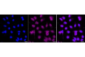 Immunocytochemical staining of HepG2 cells with RNF40 antibody (ABIN7800634), 1:1,000).