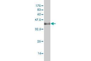 Western Blot detection against Immunogen (38. (DLX2 Antikörper  (AA 1-110))