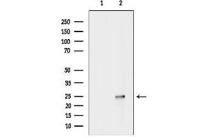 anti-Heart and Neural Crest Derivatives Expressed 2 (HAND2) (Internal Region) antibody