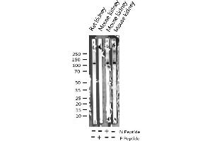 Western blot analysis of Phospho-FAK (Tyr925) expression in various lysates (FAK Antikörper  (pTyr925))