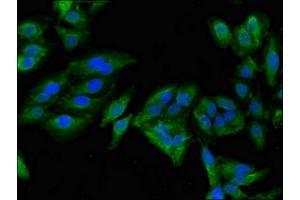 Immunofluorescent analysis of Hela cells using ABIN7143899 at dilution of 1:100 and Alexa Fluor 488-congugated AffiniPure Goat Anti-Rabbit IgG(H+L) (alpha-Mannosidase II Antikörper  (AA 31-181))