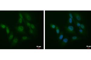 ICC/IF Image SLU7 antibody detects SLU7 protein at cytoplasm and nucleus by immunofluorescent analysis. (SLU7 Antikörper  (C-Term))