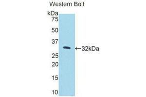 Western Blotting (WB) image for anti-Protein Kinase N2 (PKN2) (AA 67-312) antibody (ABIN1175309) (PKN2 Antikörper  (AA 67-312))