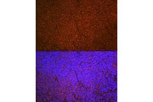 Immunofluorescence analysis of mouse spleen using SHIP11 Rabbit mAb (ABIN7267882) at dilution of 1:100 (40x lens). (INPP5D Antikörper)