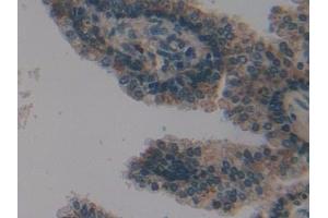 Immunohistochemistry (IHC) image for anti-Proteasome (Prosome, Macropain) 26S Subunit, Non-ATPase, 9 (PSMD9) (AA 2-223) antibody (ABIN7442213)