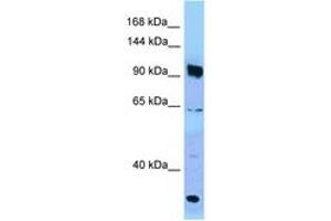 Image no. 1 for anti-PARG (PARG) (AA 770-819) antibody (ABIN6748252)