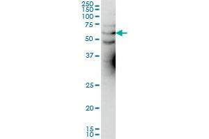 KCNA3 monoclonal antibody (M01), clone 1D8 Western Blot analysis of KCNA3 expression in Hela S3 NE . (KCNA3 Antikörper  (AA 424-523))