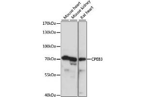 Western blot analysis of extracts of various cell lines, using CPEB3 antibody (ABIN7266666) at 1:1000 dilution. (CPEB3 Antikörper  (AA 150-400))