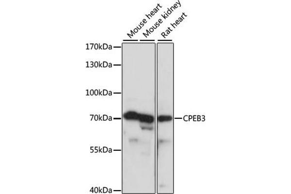 CPEB3 Antikörper  (AA 150-400)