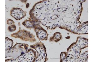 Immunoperoxidase of monoclonal antibody to ADPRH on formalin-fixed paraffin-embedded human placenta. (ADPRH Antikörper  (AA 23-121))
