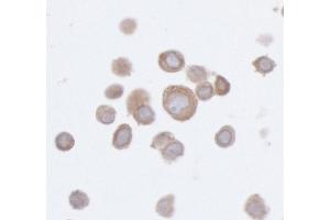 Immunocytochemistry (ICC) image for anti-Protein Tyrosine Phosphatase G1 (PTPN12) (AA 499-780) antibody (ABIN7453983) (Rekombinanter PTPN12 Antikörper  (AA 499-780))