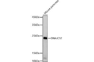 Western blot analysis of extracts of Mouse pancreas, using DN antibody (ABIN7266821) at 1:1000 dilution. (DNAJC12 Antikörper)