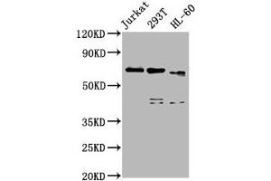 Western Blot Positive WB detected in: Jurkat whole cell lysate, 293T whole cell lysate, HL60 whole cell lysate All lanes: CBFA2T3 antibody at 5 μg/mL Secondary Goat polyclonal to rabbit IgG at 1/50000 dilution Predicted band size: 72, 63, 64, 8 kDa Observed band size: 72 kDa (CBFA2T3 Antikörper  (AA 39-159))