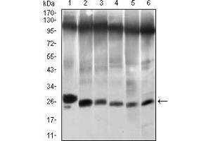 Western blot analysis using TWIST1 mouse mAb against NIH/3T3 (1), JURKAT (2), HELA (3), A549 (4), RAJI (5) and OCM-1 (6) cell lysate.