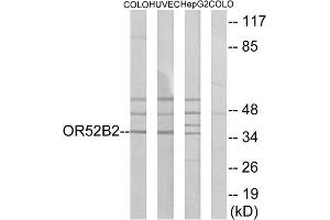 Western blot analysis of extracts from COLO cells, HUVEC cells and HepG2 cells, using OR52B2 antibody. (OR52B2 Antikörper  (Internal Region))