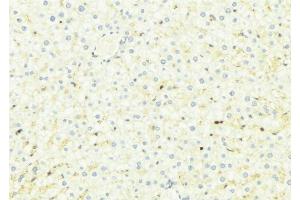 ABIN6275010 at 1/100 staining Mouse liver tissue by IHC-P.