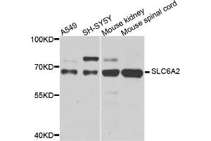Western blot analysis of extracts of various cell lines, using SLC6A2 antibody (ABIN5974706) at 1/1000 dilution. (SLC6A2 Antikörper)