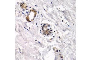 Immunohistochemistry of paraffin-embedded human normal breast using CAPN3 antibody at dilution of 1:200 (400x lens). (Calpain 3 Antikörper)