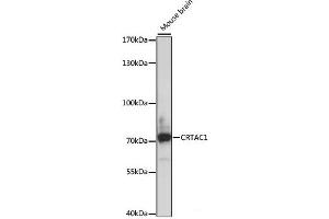 Western blot analysis of extracts of Mouse brain using CRTAC1 Polyclonal Antibody at dilution of 1:1000.
