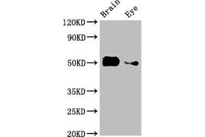 Western Blot Positive WB detected in: Zebrafish brain tissue, Zebrafish eye tissue All lanes: tuba8l2 antibody at 3 μg/mL Secondary Goat polyclonal to rabbit IgG at 1/50000 dilution Predicted band size: 51 kDa Observed band size: 51 kDa (tuba8l2 Antikörper  (AA 1-449))