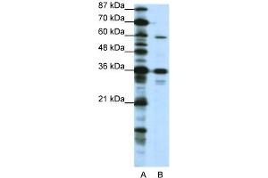 WB Suggested Anti-CREB3L1 Antibody Titration:  1. (CREB3L1 Antikörper  (N-Term))