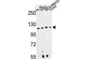 Western Blotting (WB) image for anti-Retinitis Pigmentosa GTPase Regulator Interacting Protein 1 (RPGRIP1) antibody (ABIN3003942)