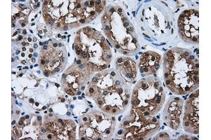 Immunohistochemical staining of paraffin-embedded liver tissue using anti-HDAC10mouse monoclonal antibody. (HDAC10 Antikörper)