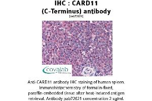 Image no. 1 for anti-Caspase Recruitment Domain Family, Member 11 (CARD11) (C-Term) antibody (ABIN1732635) (CARD11 Antikörper  (C-Term))