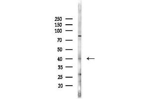 anti-Pyrroline-5-Carboxylate Reductase 1 (PYCR1) (Internal Region) antibody