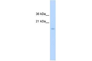 WB Suggested Anti-CENPA Antibody Titration:  1. (CENPA Antikörper  (N-Term))