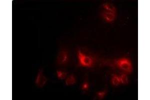 Immunofluorescent analysis of CCAR1 staining in HepG2 cells. (CCAR1 Antikörper)