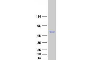 Validation with Western Blot (PICK1 Protein (Transcript Variant 2) (Myc-DYKDDDDK Tag))