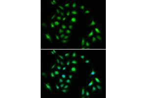 Immunofluorescence analysis of A549 cells using CHUK antibody (ABIN5971093). (IKK alpha Antikörper)