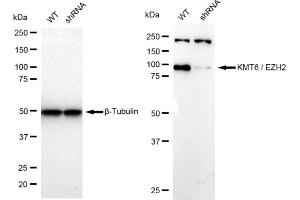 Western blotting analysis using KMT6 / EZH2 antibody (ABIN7798447).
