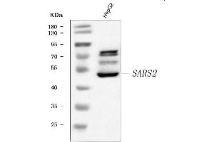 Western blot analysis of SARS2 using anti-SARS2 antibody (ABIN7601804).