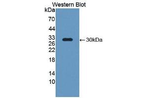 Western blot analysis of the recombinant protein. (NOS2 Antikörper  (AA 734-966))