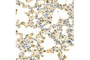 Immunohistochemistry analysis of paraffin embedded mouse lung using contactin-1 (ABIN7073572) at dilution of 1: 300 (Contactin 1 Antikörper)