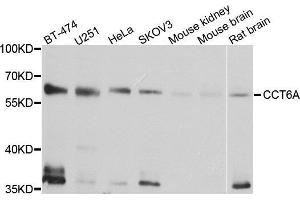 Western Blotting (WB) image for anti-Chaperonin Containing TCP1, Subunit 6A (Zeta 1) (CCT6A) (AA 80-250) antibody (ABIN1679063)