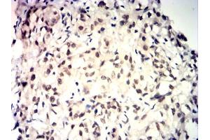 Immunohistochemistry (IHC) image for anti-TAR DNA Binding Protein (TARDBP) antibody (ABIN7193979)