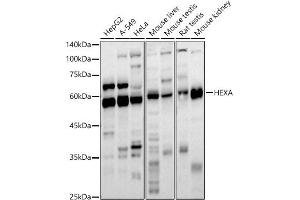 Western blot analysis of extracts of various cell lines, using HEXA antibody (ABIN6127520, ABIN6141731, ABIN6141733 and ABIN6221286) at 1:1000 dilution. (Hexosaminidase A Antikörper  (AA 270-529))
