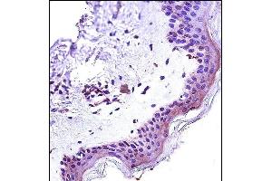 Immunohistochemistry (Paraffin-embedded Sections) (IHC (p)) image for anti-Signal Transducer and Activator of Transcription 2, 113kDa (STAT2) (AA 186-215), (N-Term) antibody (ABIN657671)