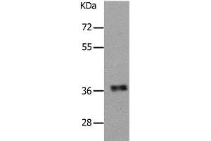 Western Blot analysis of Human fetal muscle tissue using PARD6A Polyclonal Antibody at dilution of 1:650 (PARD6A Antikörper)