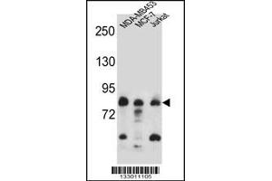 Western blot analysis in MDA-MB453,MCF-7,Jurkat cell line lysates (35ug/lane). (AFG3L2 Antikörper  (N-Term))